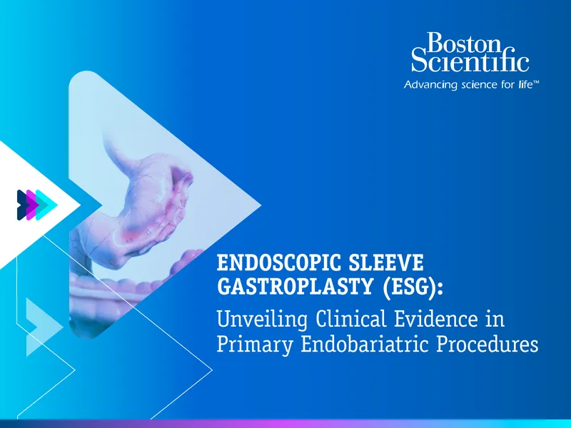 Clinical Evidence for Endoscopic Sleeve Gastroplasty Procedures