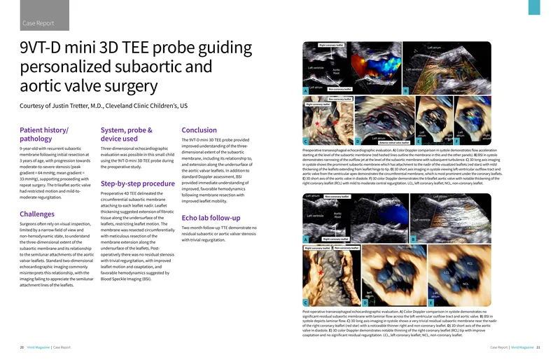 Guidance on 3D TEE Probe for Subaortic Surgery