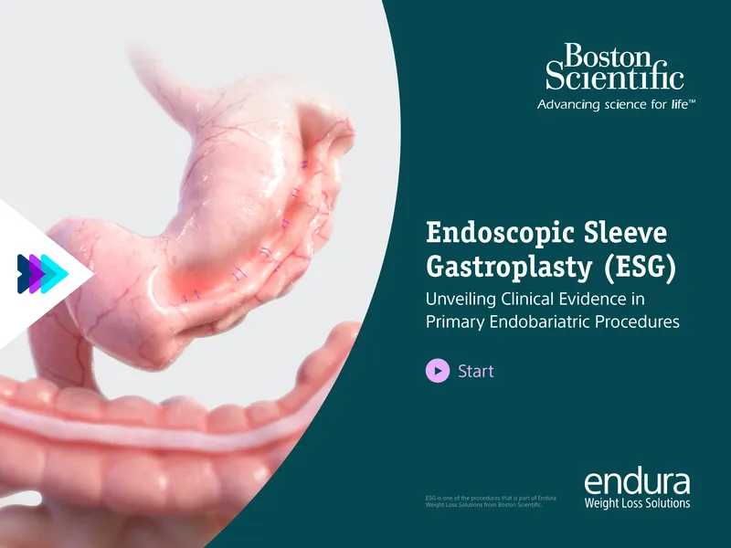 Endoscopic Sleeve Gastroplasty Clinical Evidence Report