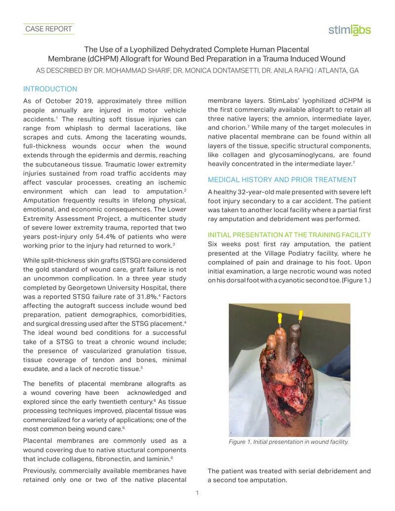 Use of Lyophilized Dehydrated Human Placental Membrane Allograft