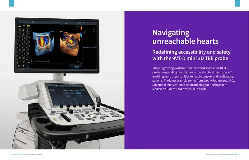 Evaluation of the 9VT-D Mini 3D TEE Probe
