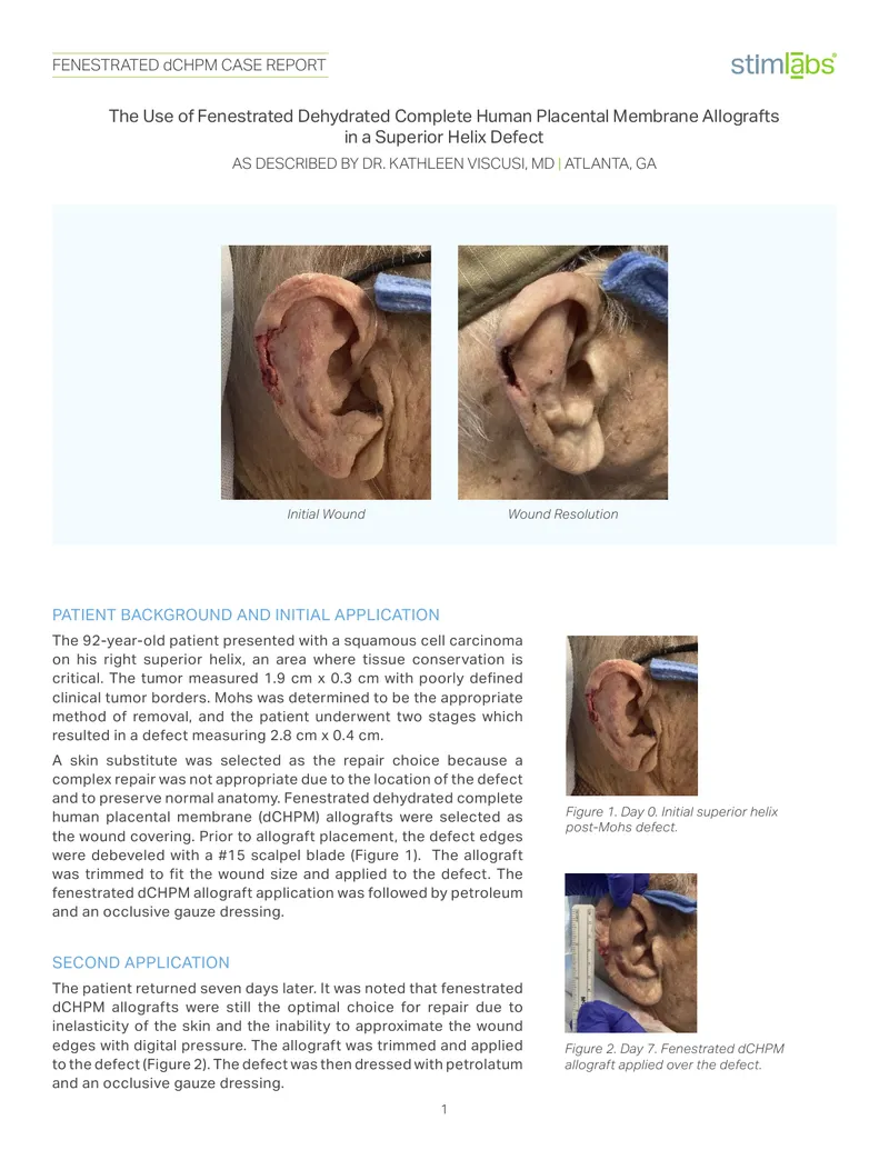 Use of Fenestrated dCHPM Allografts in Wound Repair