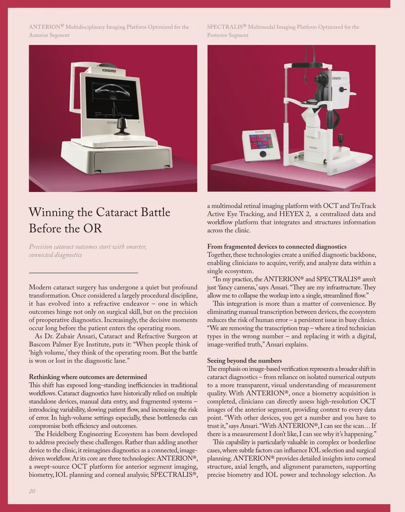 Connected Diagnostics in Modern Cataract Surgery