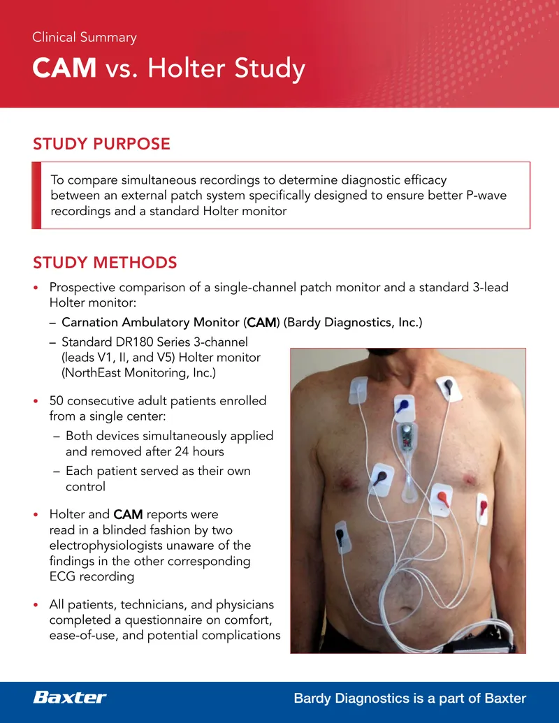 Comparison of CAM and Holter Monitor for Arrhythmia Detection