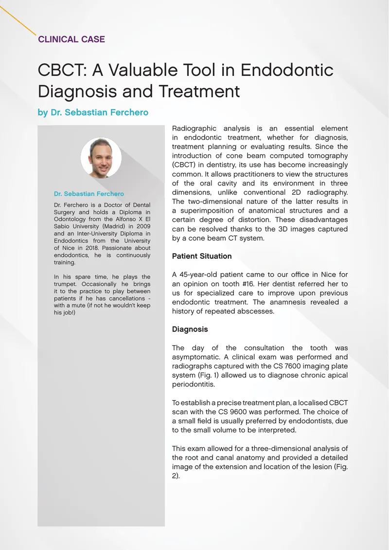 CBCT in Endodontic Diagnosis and Treatment
