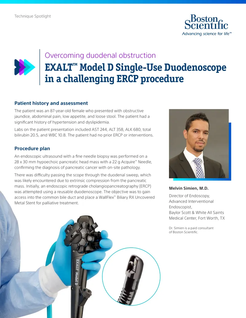 Overcoming Duodenal Obstruction with EXALT Model D